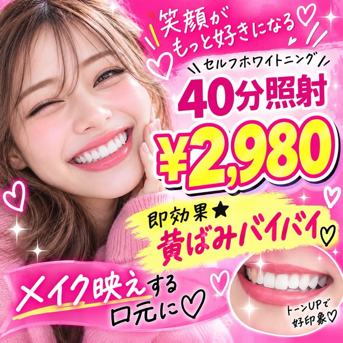 【初回体験】40分照射¥2,980/笑顔に自信を持てる白い歯に🦷✨の写真
