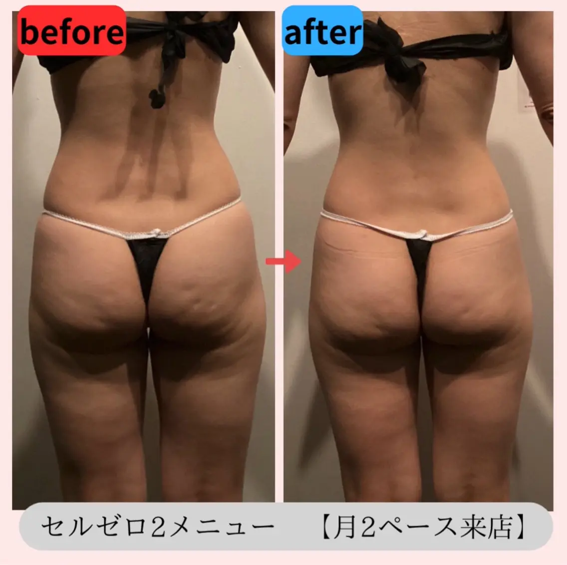 〈60分間マシン当て放題〉痩身機器3台使用✨　痩せたい🔥疲労回復🪷色んなお悩み対応◎ ￥4000の写真