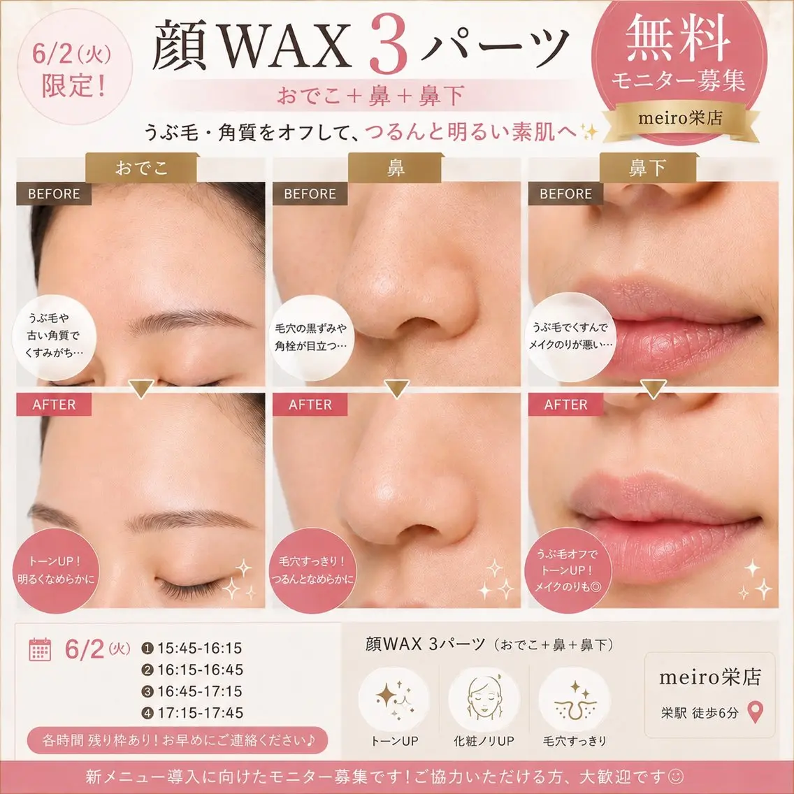 🈳6/2限定‼️無料練習モデル🌱フェイシャルワックス(おでこ、鼻周り、鼻下)の写真