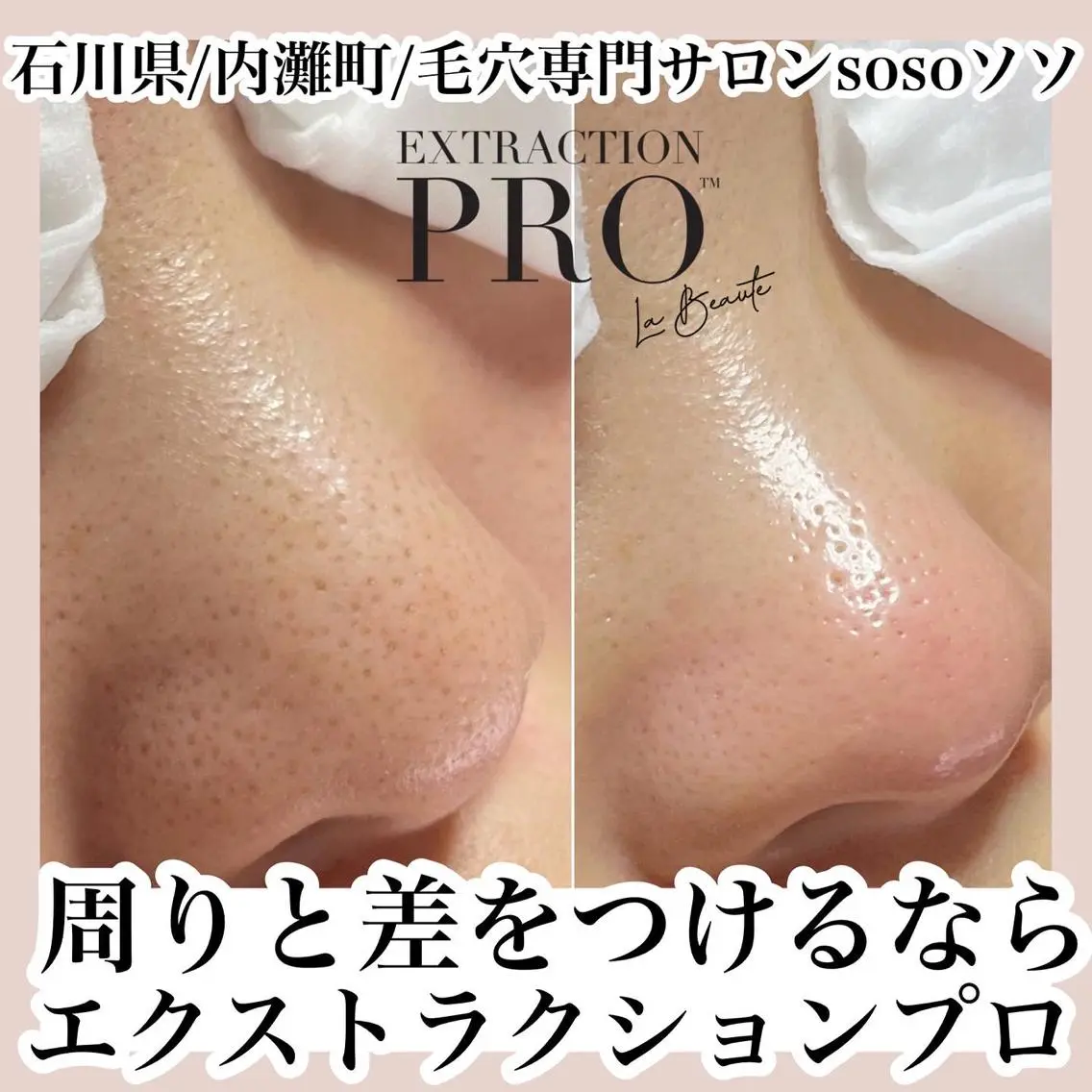 salon soso(ソソ)のエステ・リラクイメージ