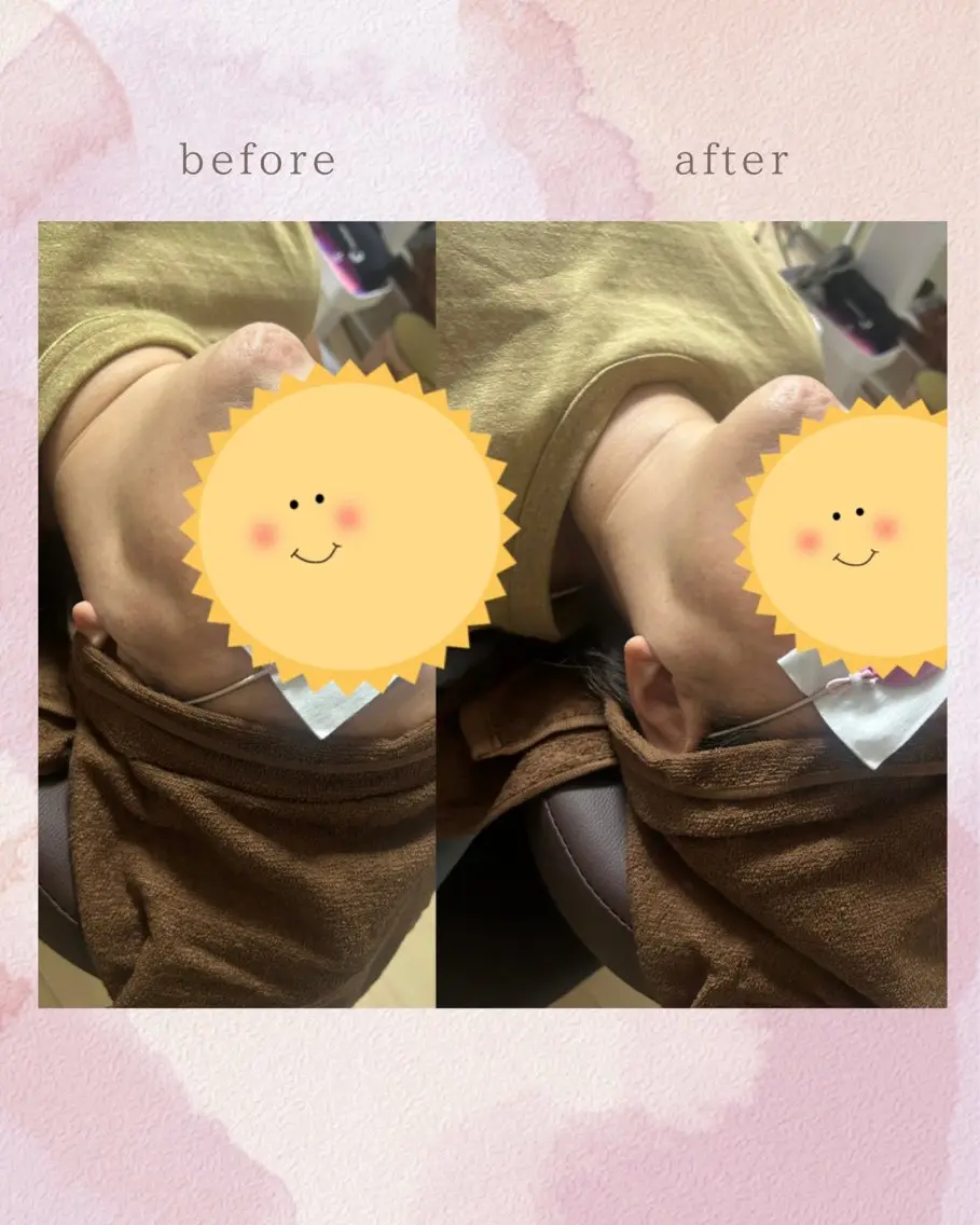 エステ Belle ＋vi（ベル）のその他イメージ