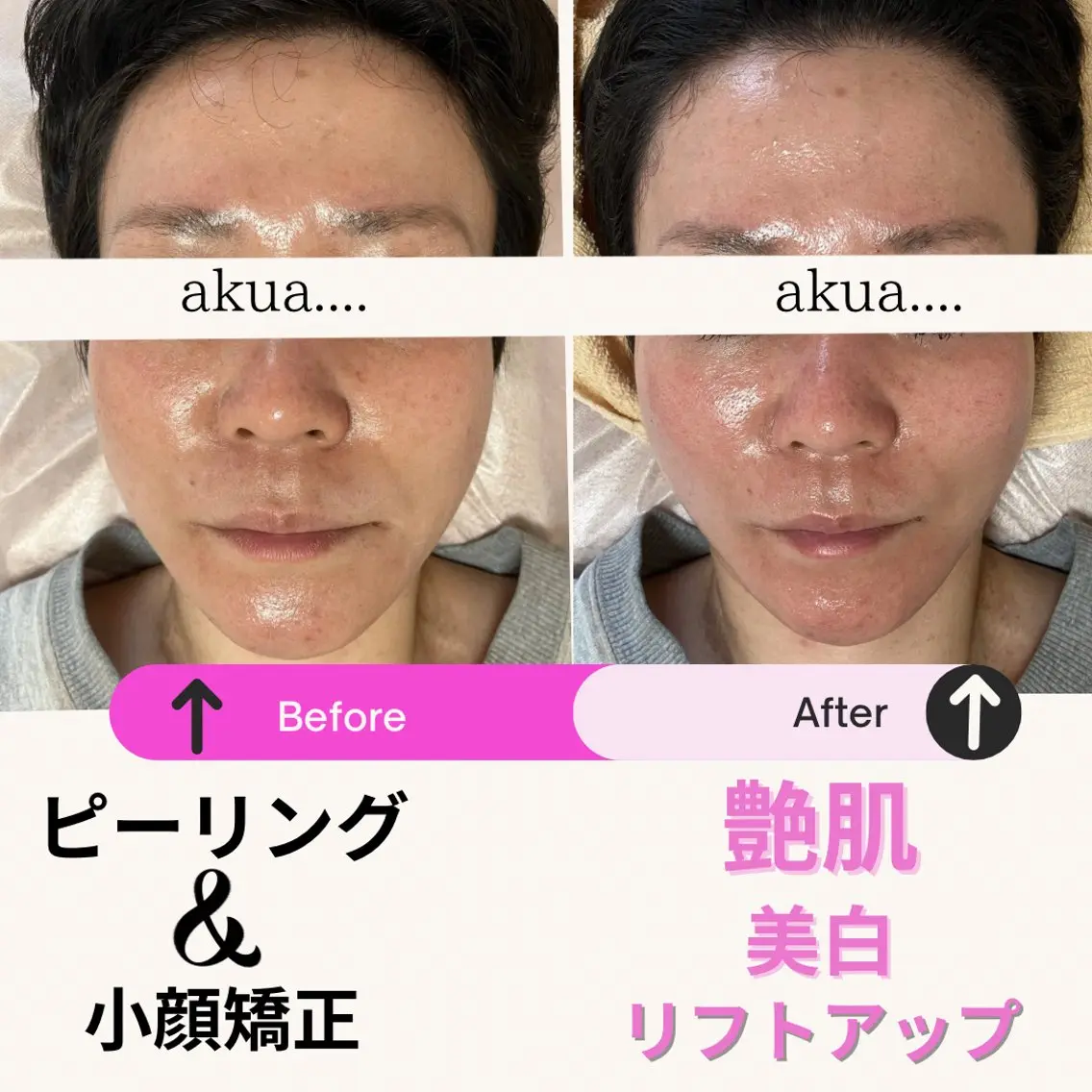 その他 LUMINAルミナ 【肌管理サロン】のその他イメージ