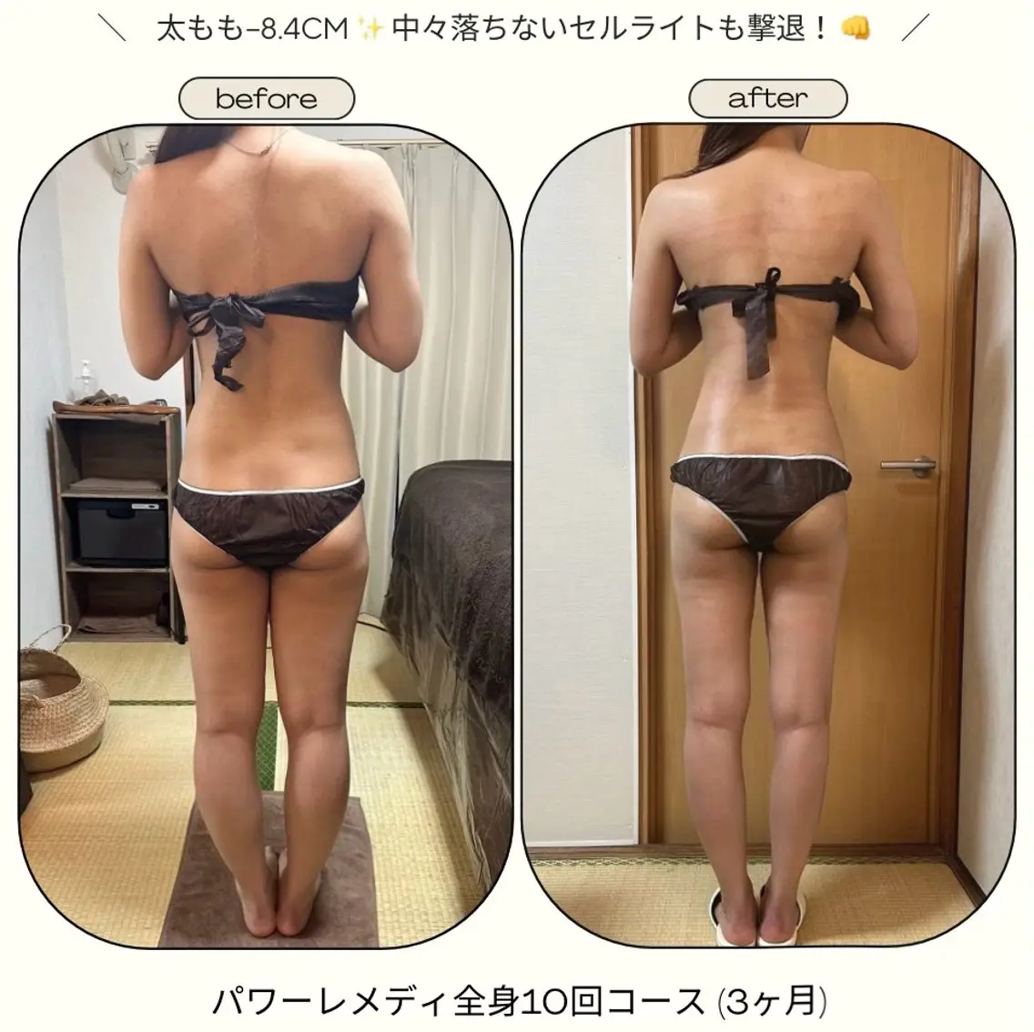 《本気痩せ×疲労改善 》  BILOOPのエステ・リラクイメージ