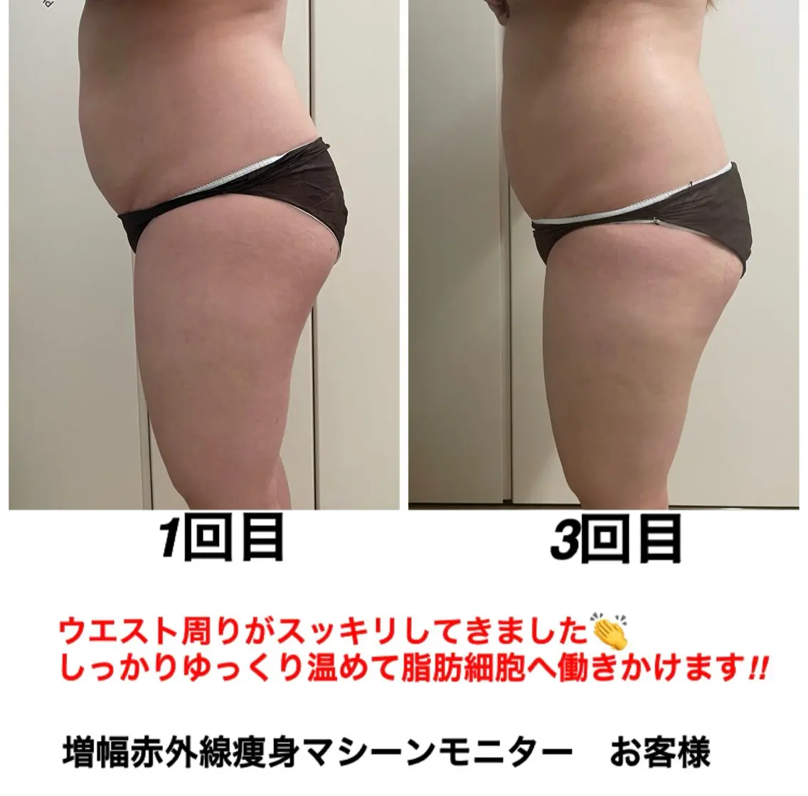 ネイル・エステサロン UILANIのエステ・リラクイメージ