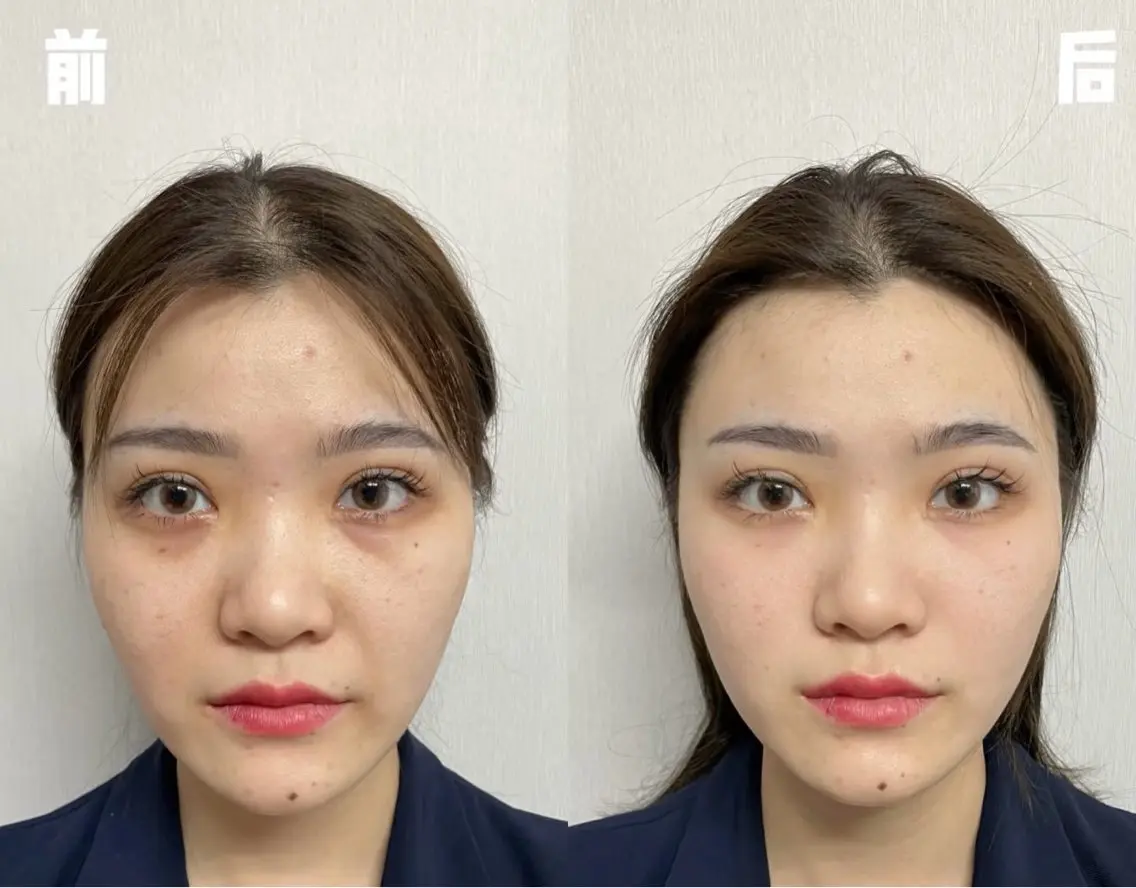 アイブロウ エステ リラク 愛維美水光美肌専門店 メンズレディースokのエステ・リラクイメージ