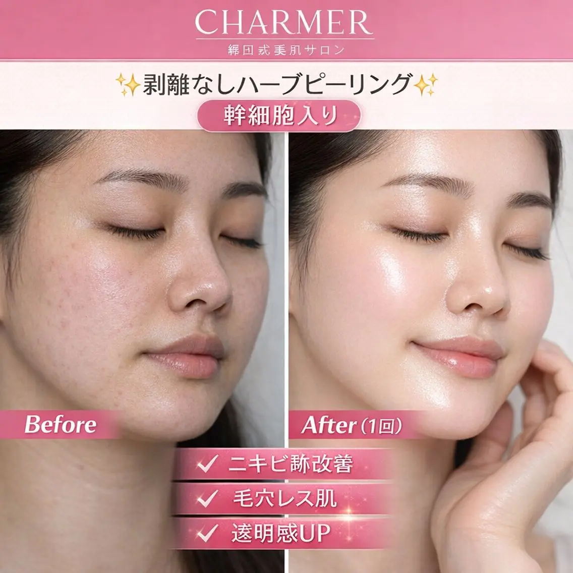 エステ CHARMER 韓国式美肌サロンのエステ・リラクイメージ