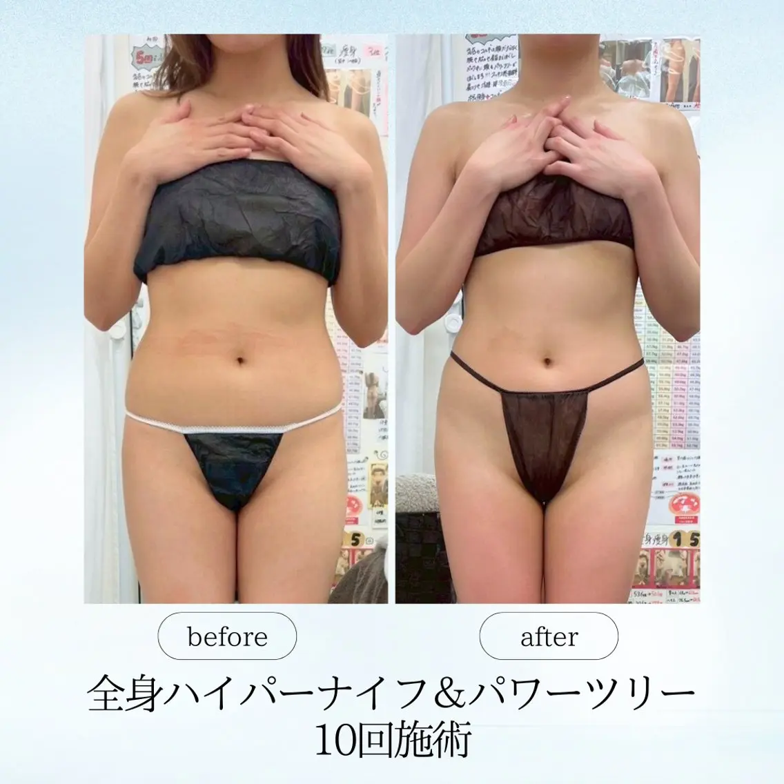 エステ リラク 《痩身、小顔専門店》 エスプレッソのエステ・リラクイメージ