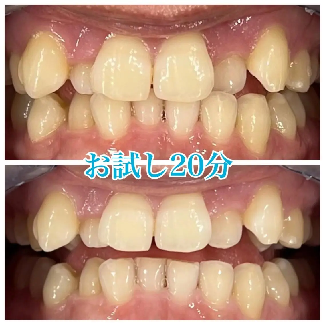 ホワイトニング🦷 ネイル💅LEAのその他イメージ