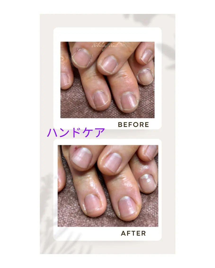 ハンドケアの写真