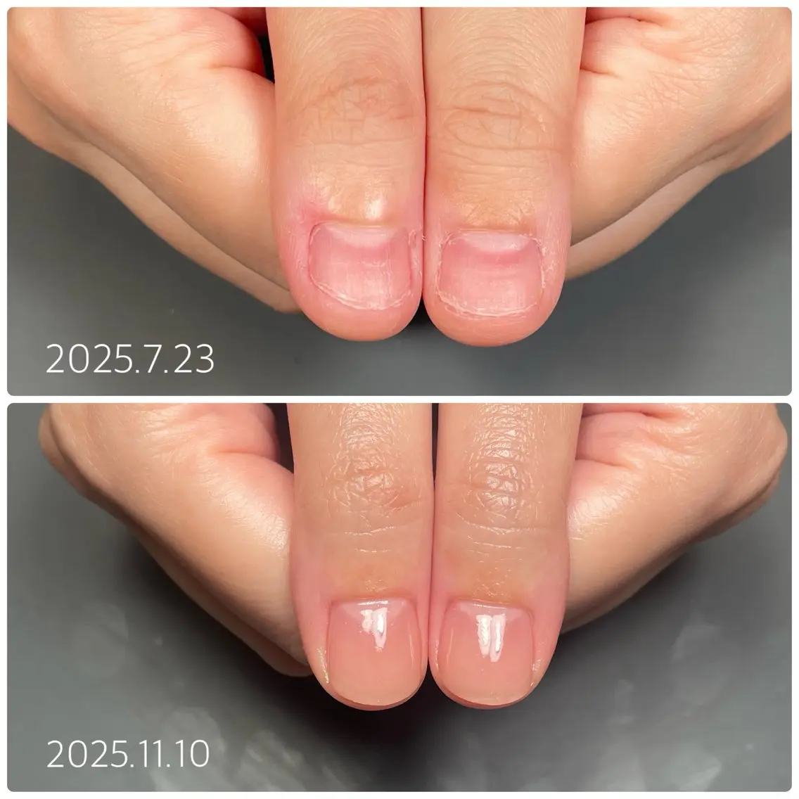 ネイル ハンドネイル 後藤 ももえのネイルデザイン