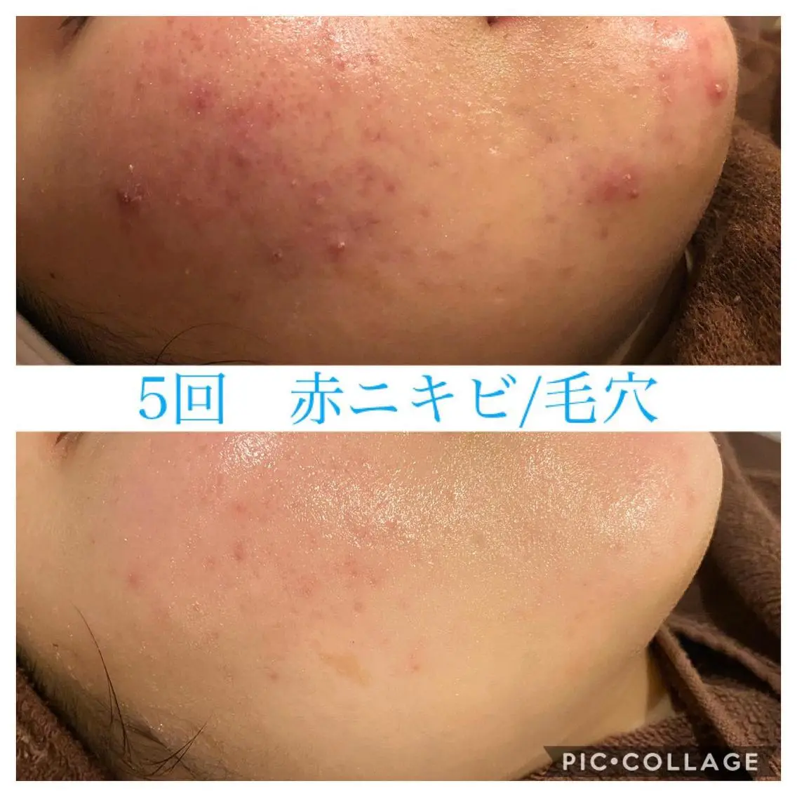 ショート カラー パーマ ヘアアレンジ メンズ ネイル マツエク・マツパ エステ リラク EnsorClair 代表 野口真央のエステ・リラクイメージ