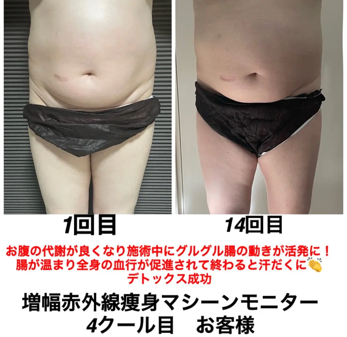 ネイル・エステサロン UILANIのエステ・リラクイメージ