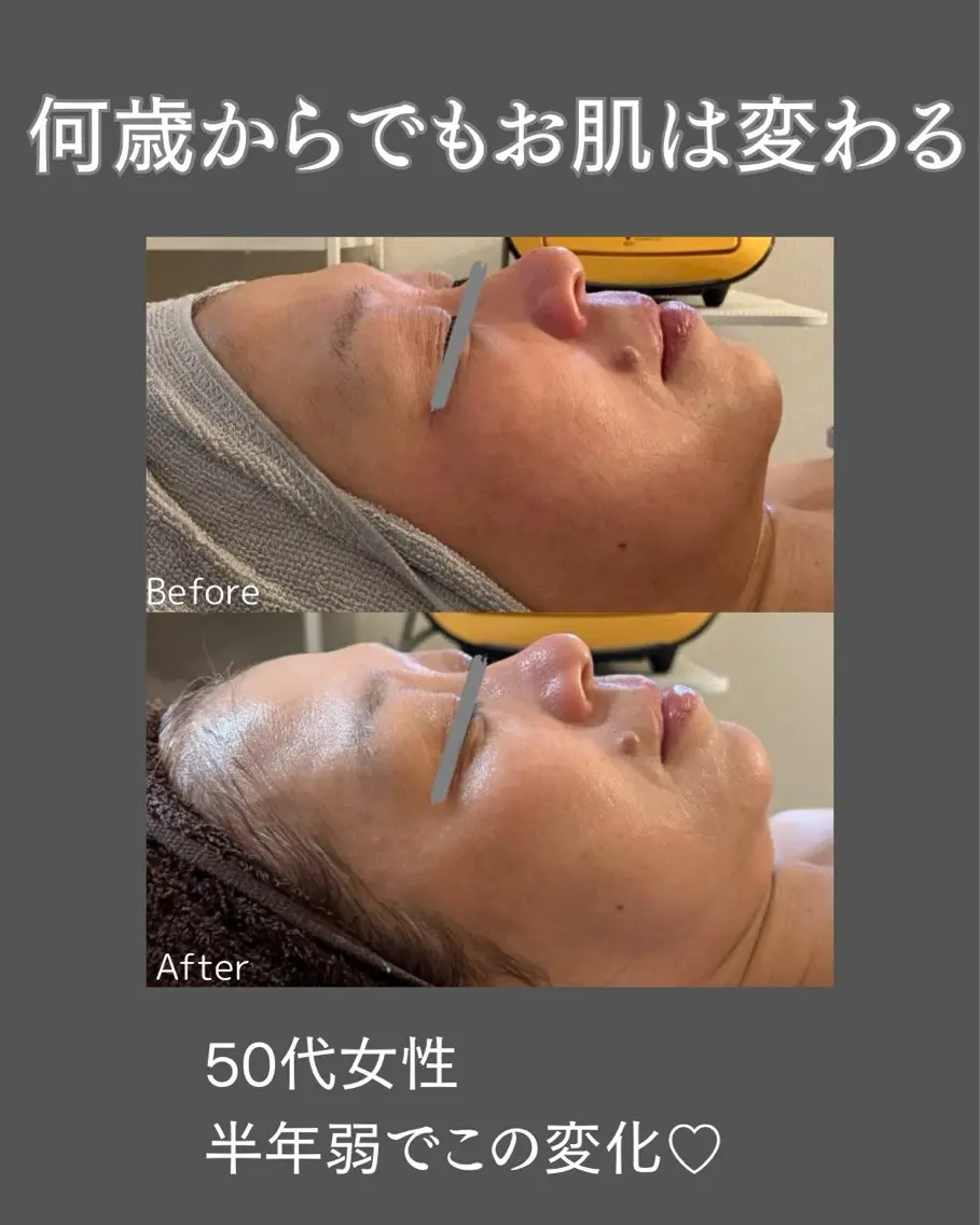 BLOSSOM 菊地のエステ・リラクイメージ