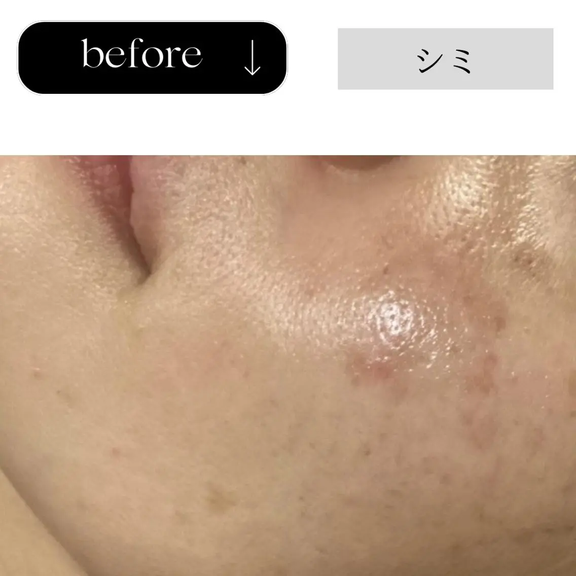 エステ beauty CHOOSEのエステ・リラクイメージ