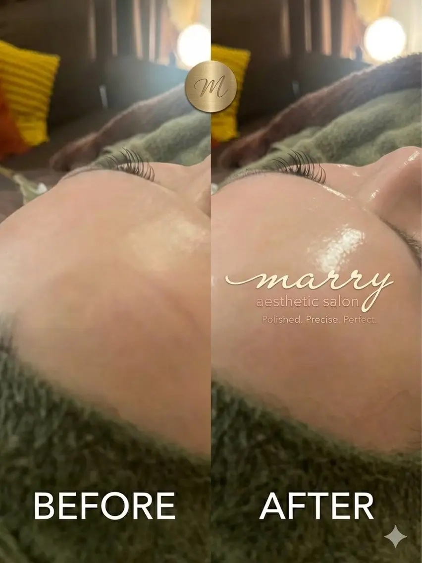 エステサロン marryのエステ・リラクイメージ