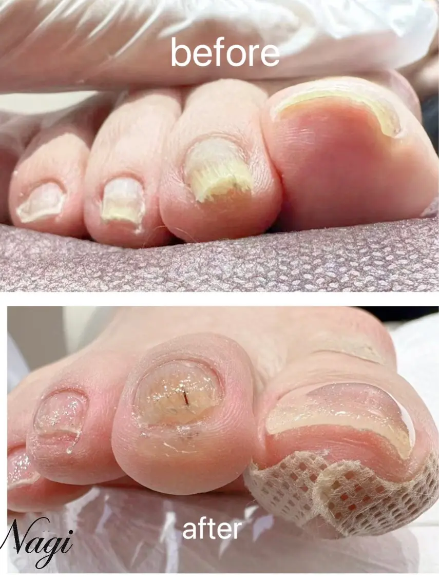 ネイル Nagi  Nail 本山のネイルデザイン