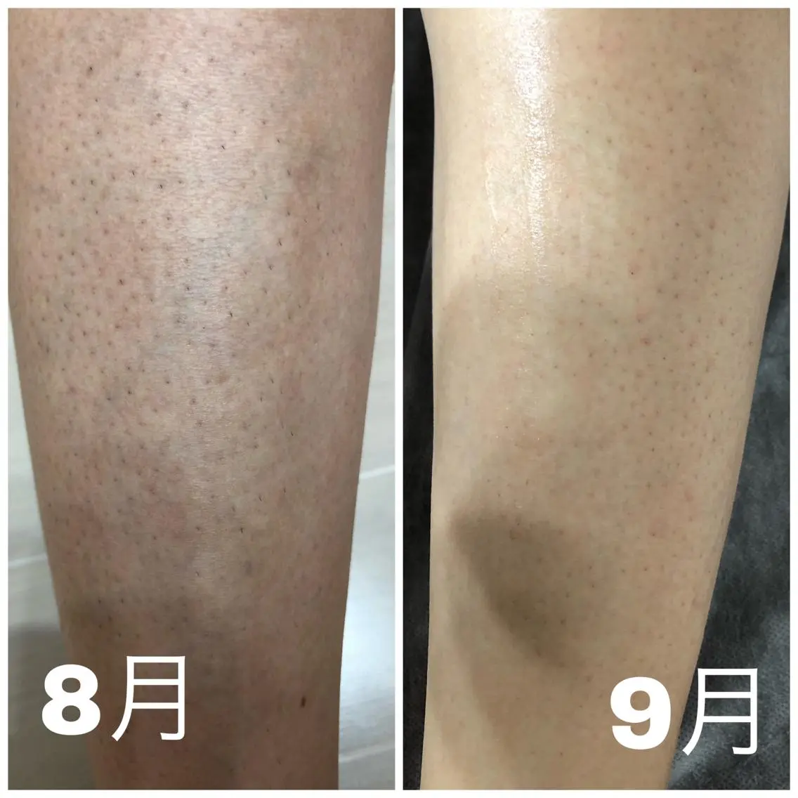 CHERIMO シェリモのネイルデザイン