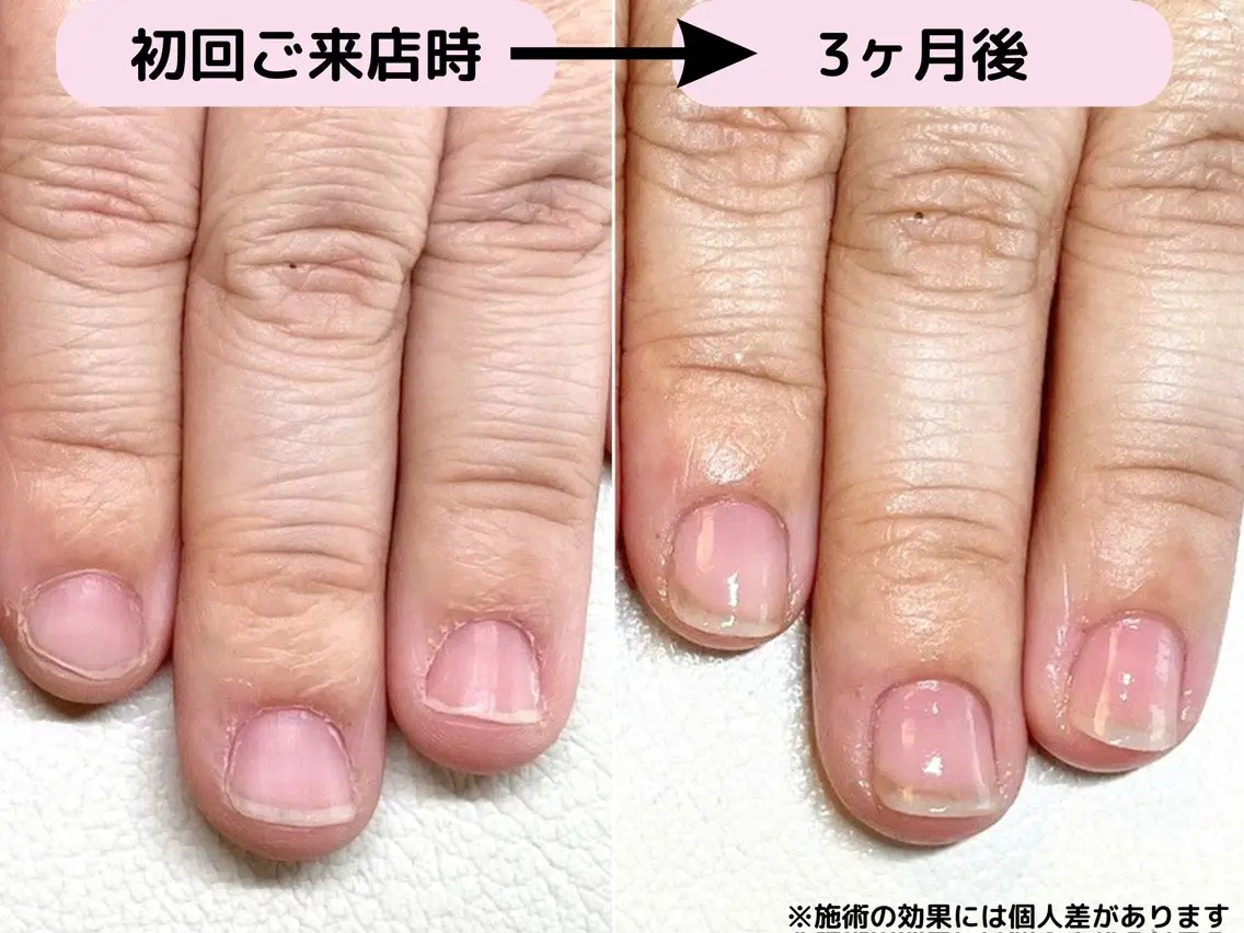 ネイル ハンドケア 自爪育成専門店 Kapilinaのネイルデザイン