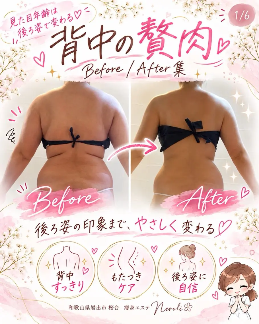 切らない脂肪吸引🔥 Neroliまりこのエステ・リラクイメージ