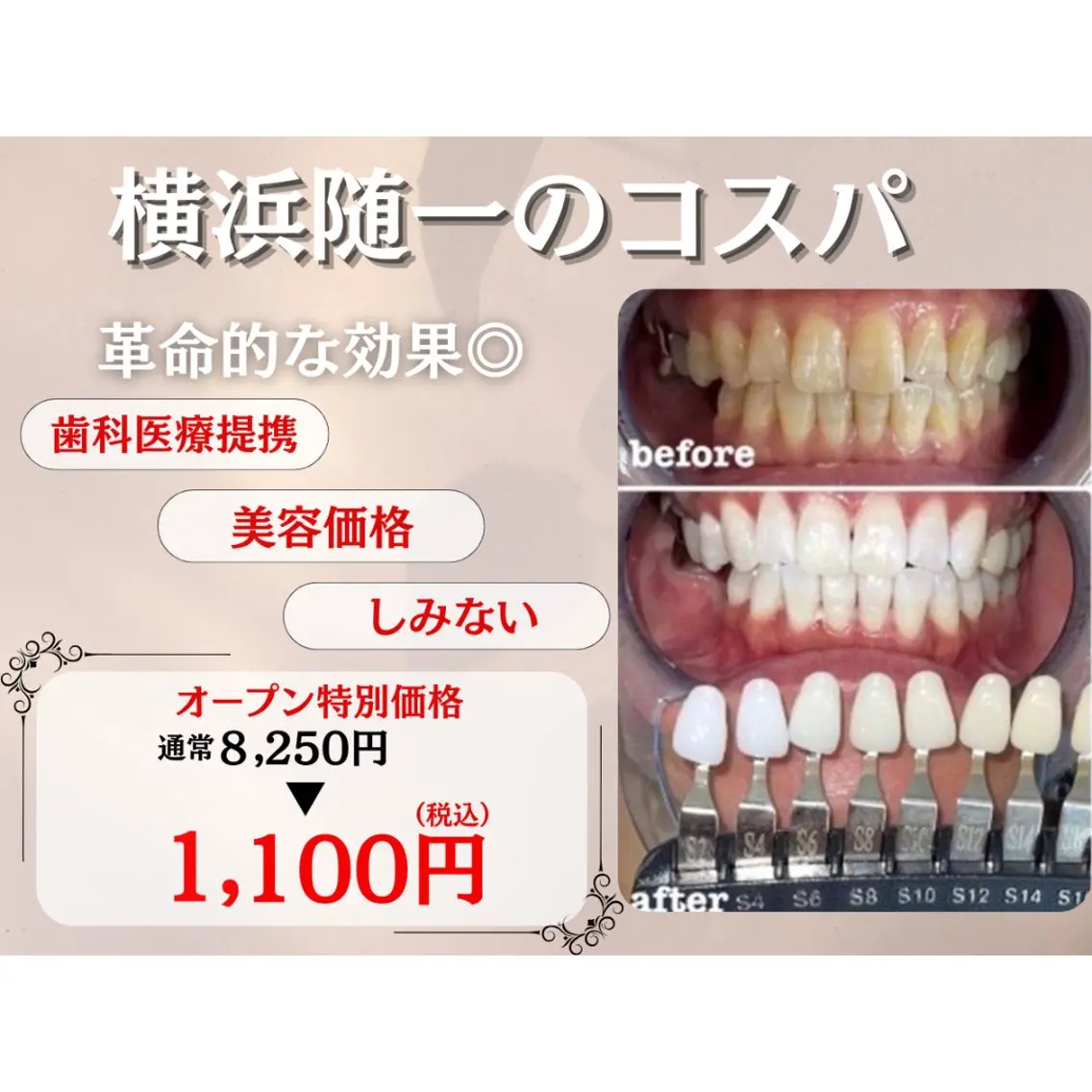 エステ ピュアホワイトニング 横浜店のエステ・リラクイメージ