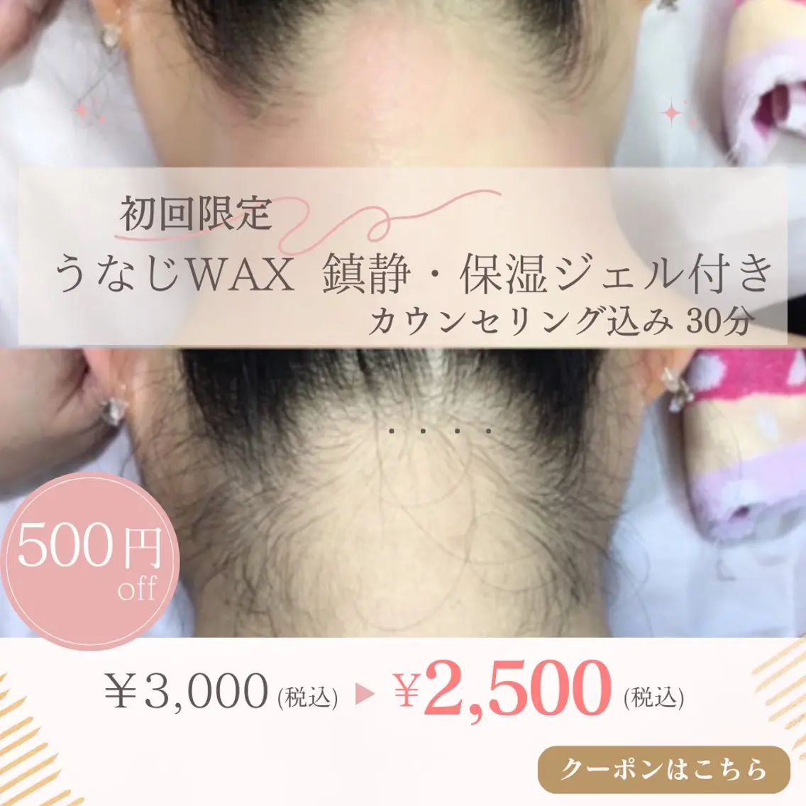 うなじWAX🍯鎮静・保湿ジェル付きの写真