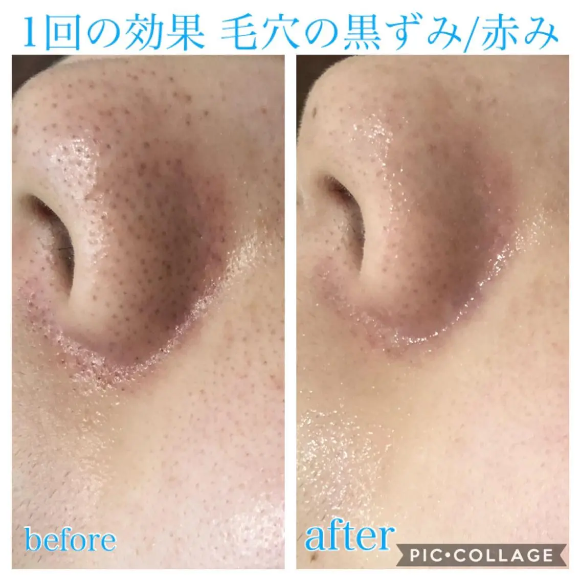 ロング カラー パーマ ヘアアレンジ キッズ ネイル マツエク・マツパ エステ リラク EnsorClair 代表　野口真央のエステ・リラクイメージ