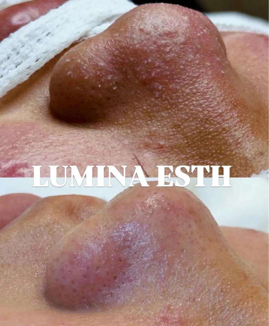LUMINA ESTHのエステ・リラクイメージ