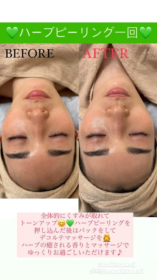 メンズ エステ Salon de Lino 御器所のエステ・リラクイメージ