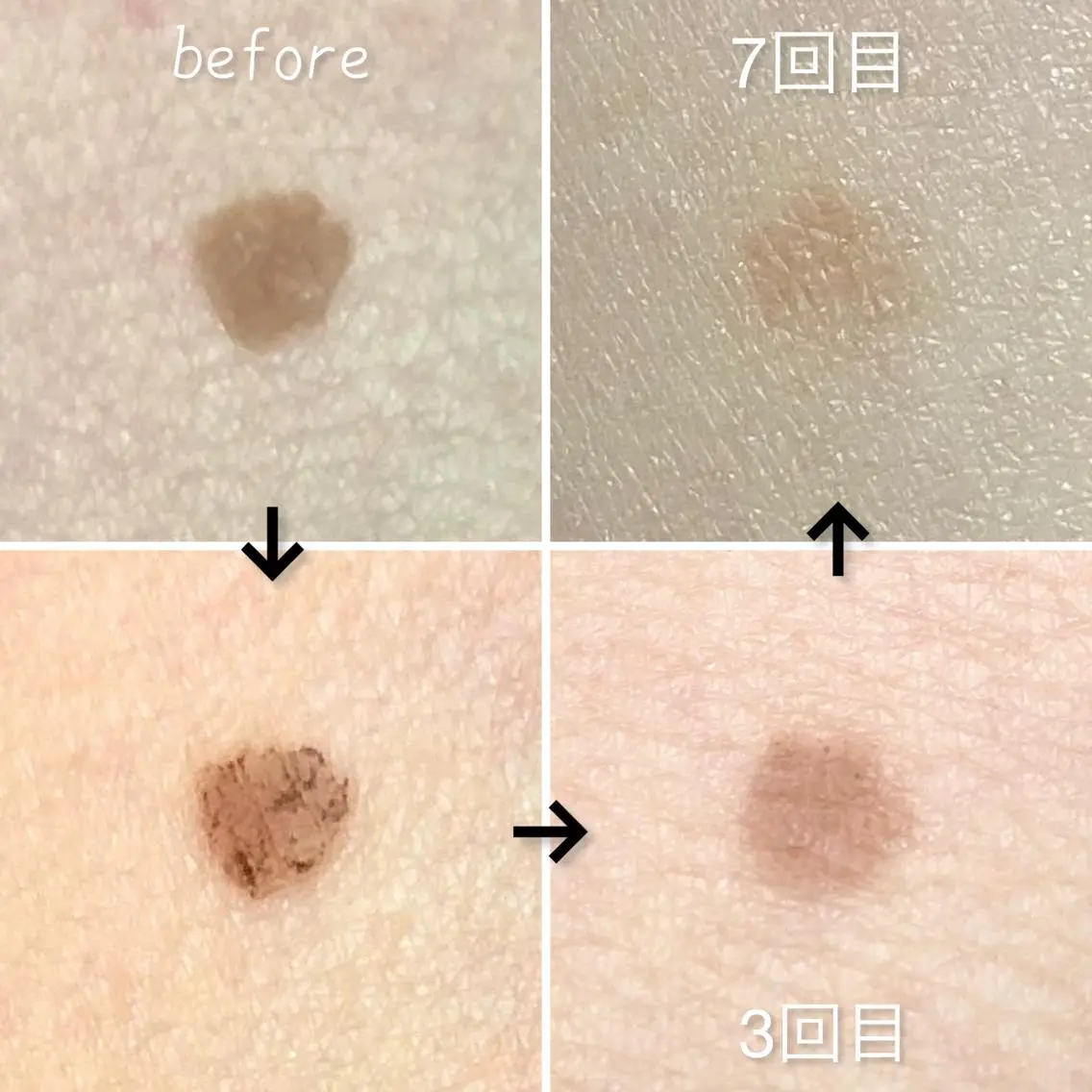 セミロング カラー メンズ キッズ エステ セルフ脱毛 One Salonのエステ・リラクイメージ