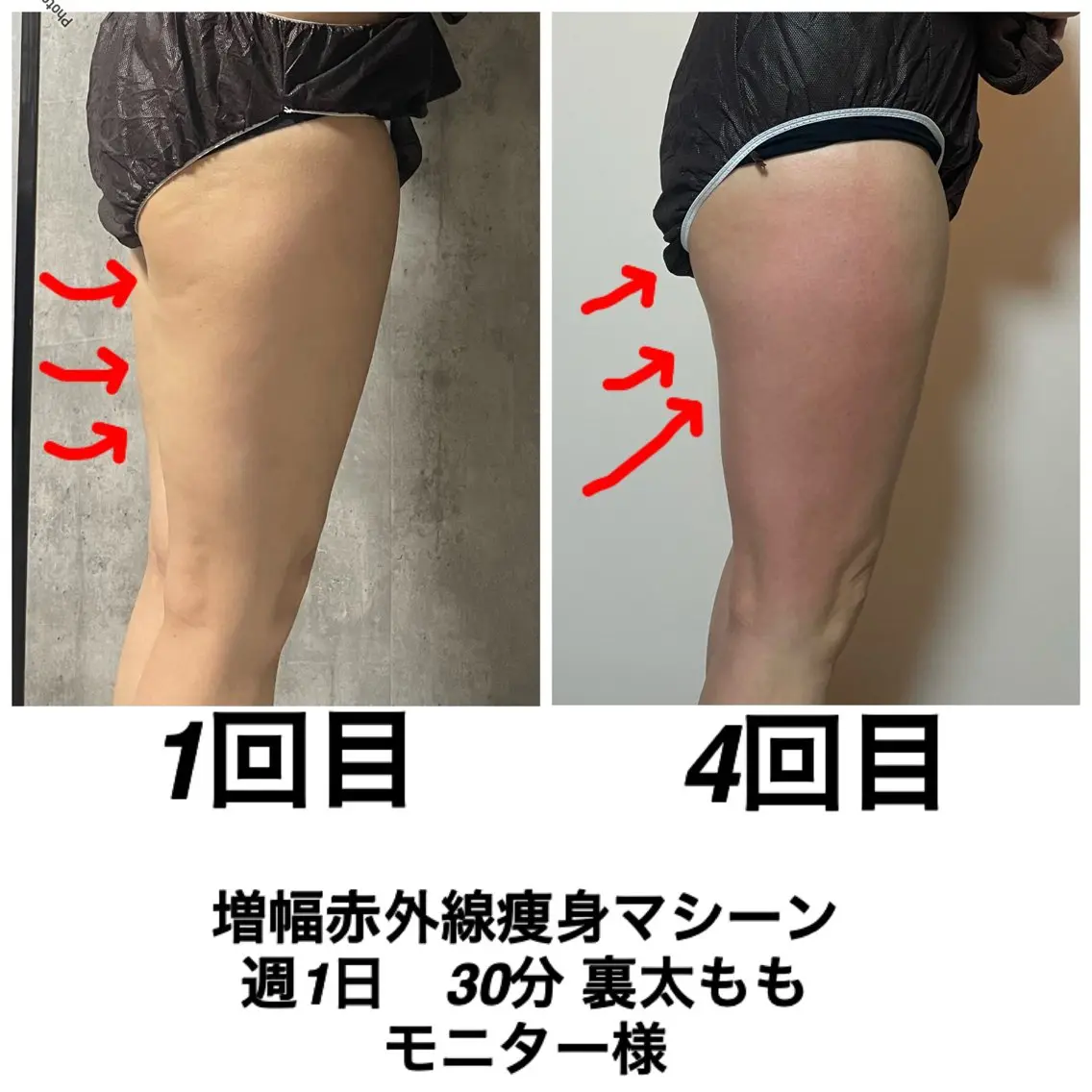 ネイル・エステサロン UILANIのエステ・リラクイメージ
