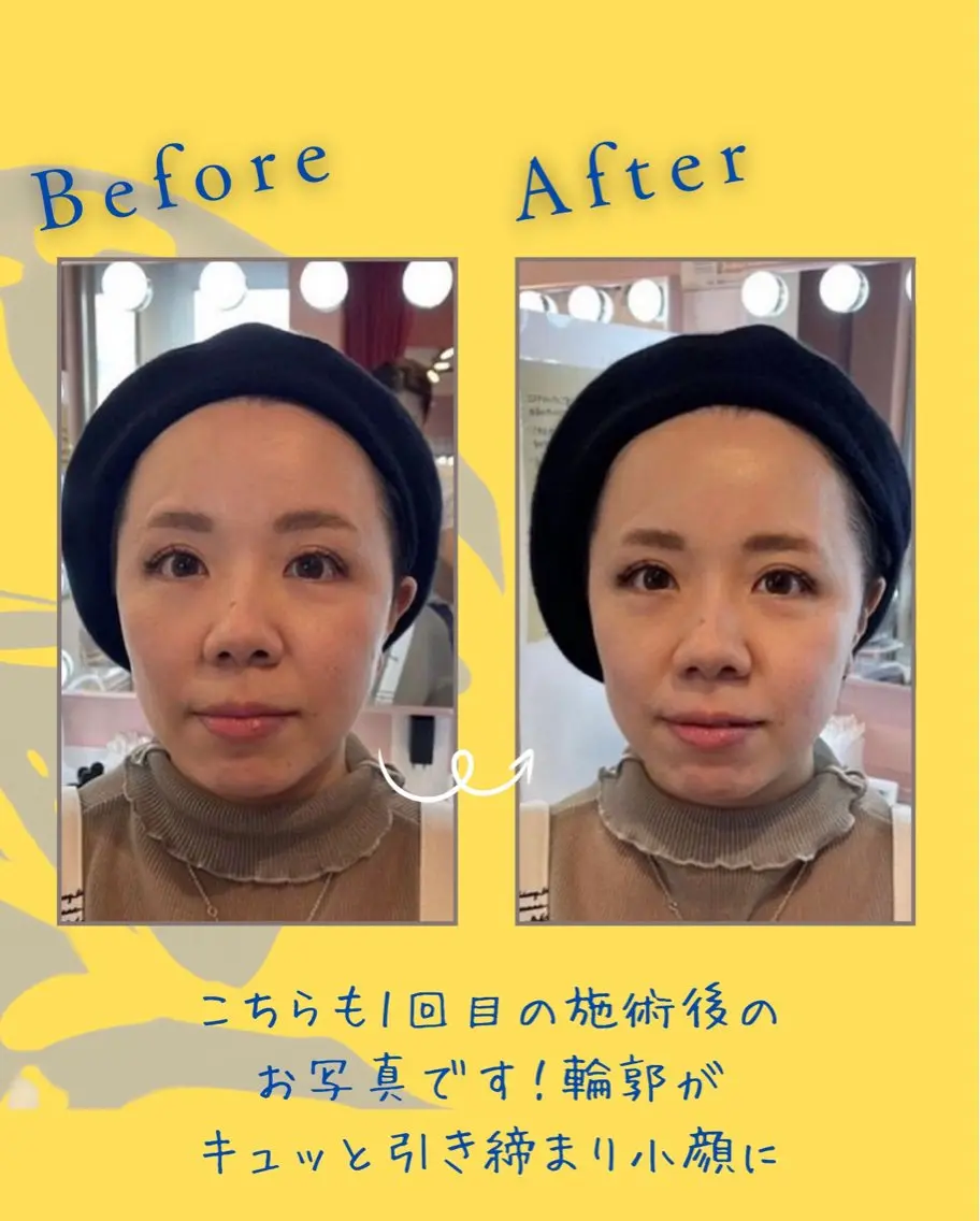 セルフ脱毛・光エステ LISALISAのエステ・リラクイメージ