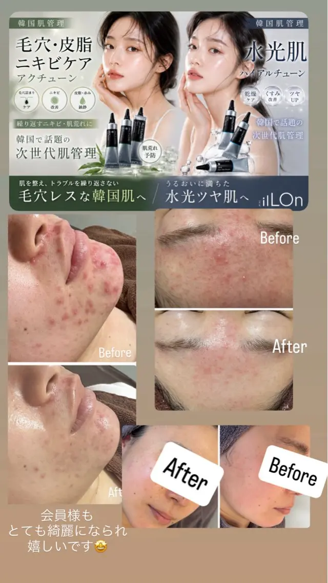 エステ 桐山 まどかのエステ・リラクイメージ