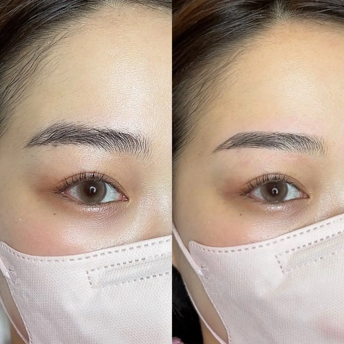 眉毛+額+鼻+口元waxの写真