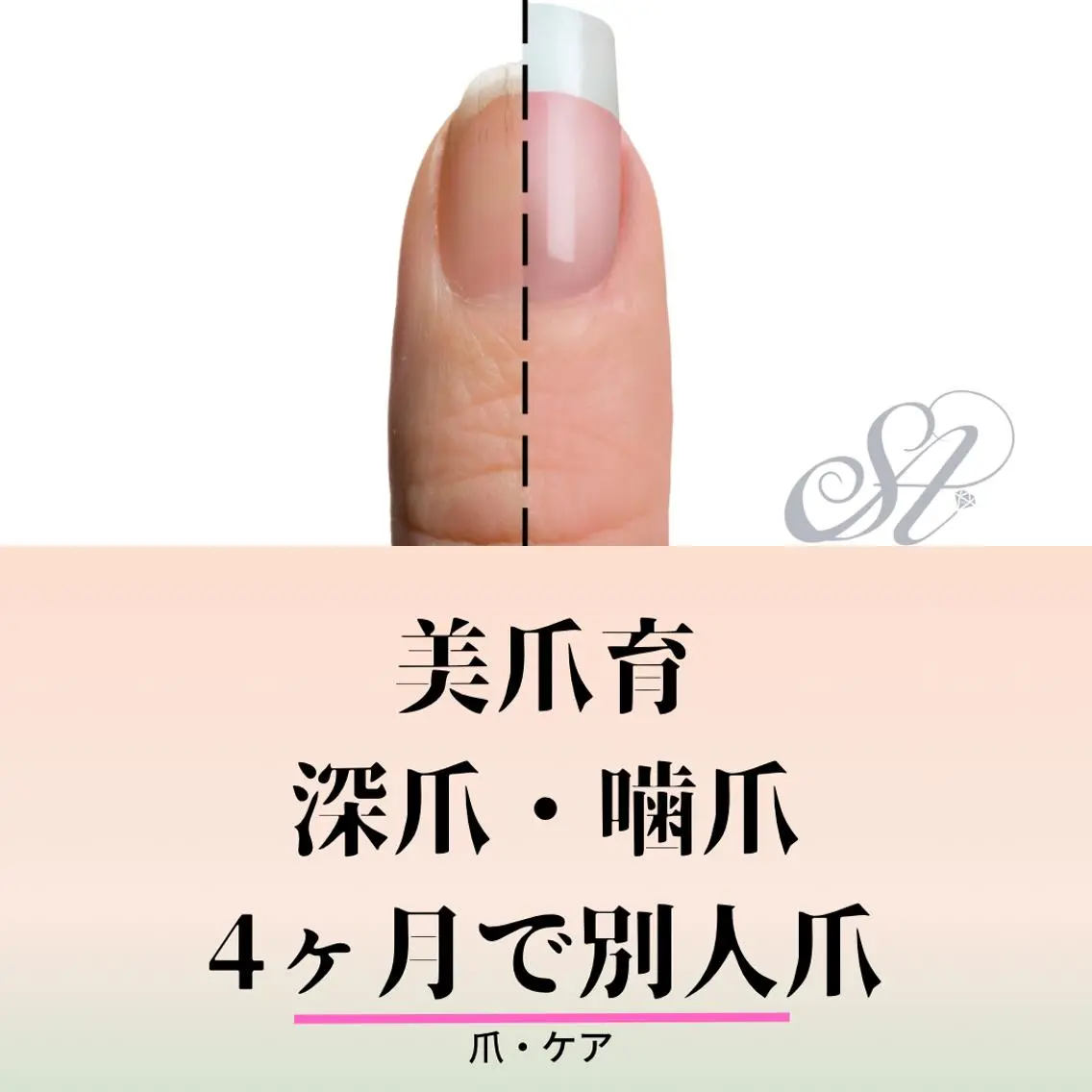 深爪噛爪★改善憧れの指先計8回みるみる爪育4ヶ月コースの写真