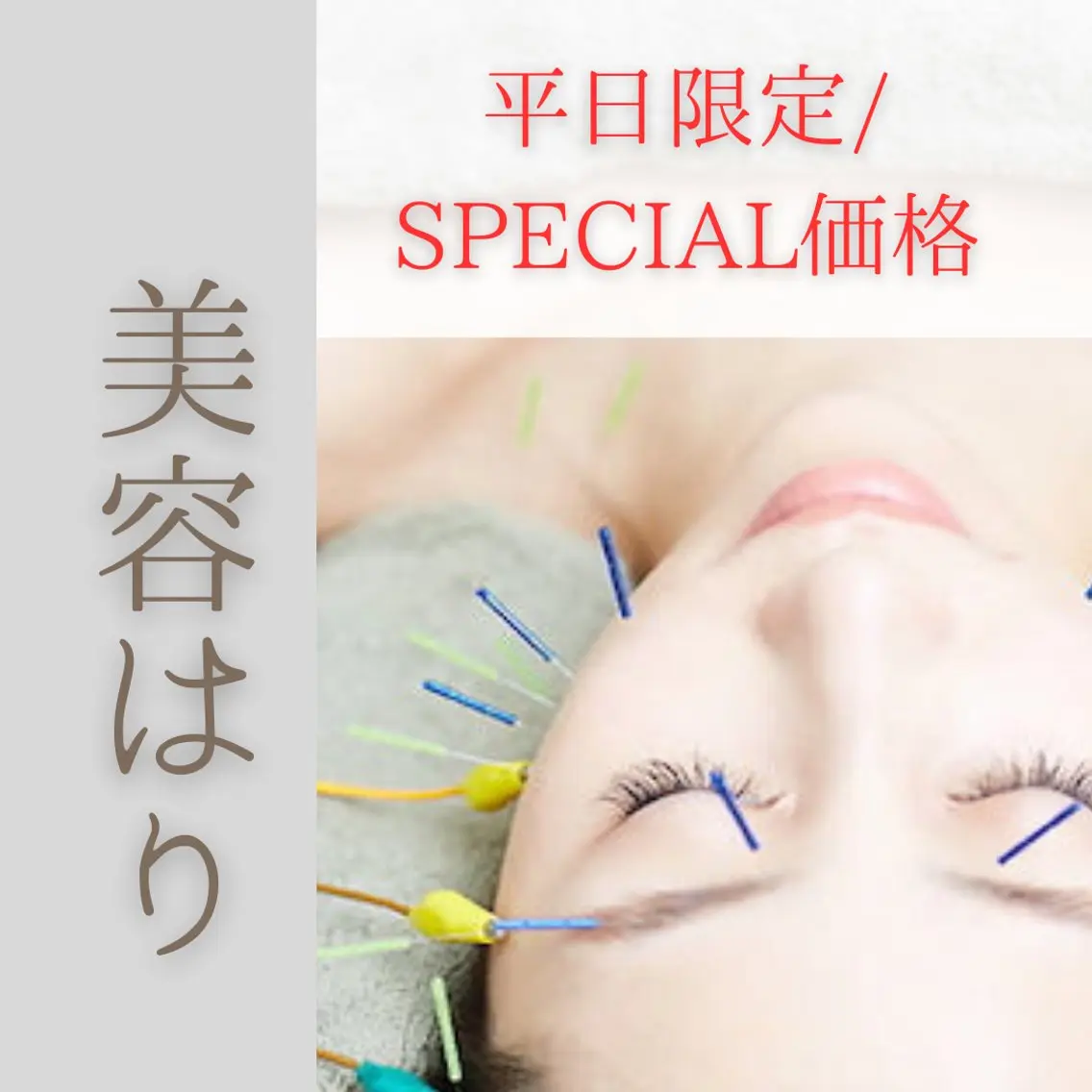 【平日限定】【2名様限り】【お一人様2回まで】【美鍼30分】食いしばり/ほうれい線/クマ・くすみ/フェイスライン🎶の写真