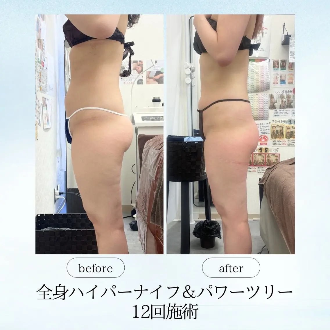 エステ リラク 《痩身、小顔専門店》 エスプレッソのエステ・リラクイメージ