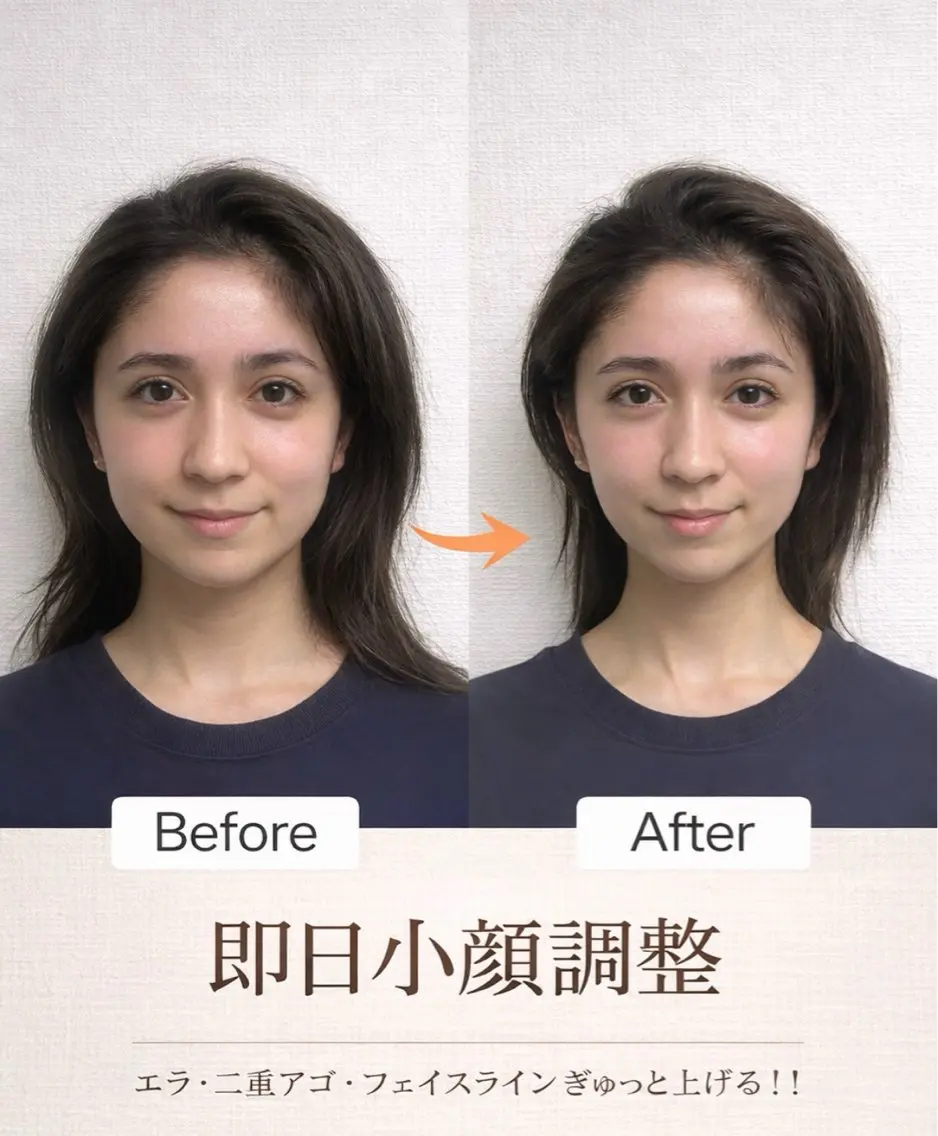 小顔矯正✨【ドライヘッドスパ×小顔矯正】効果→リフトUP・たるみ・シワなど！の写真