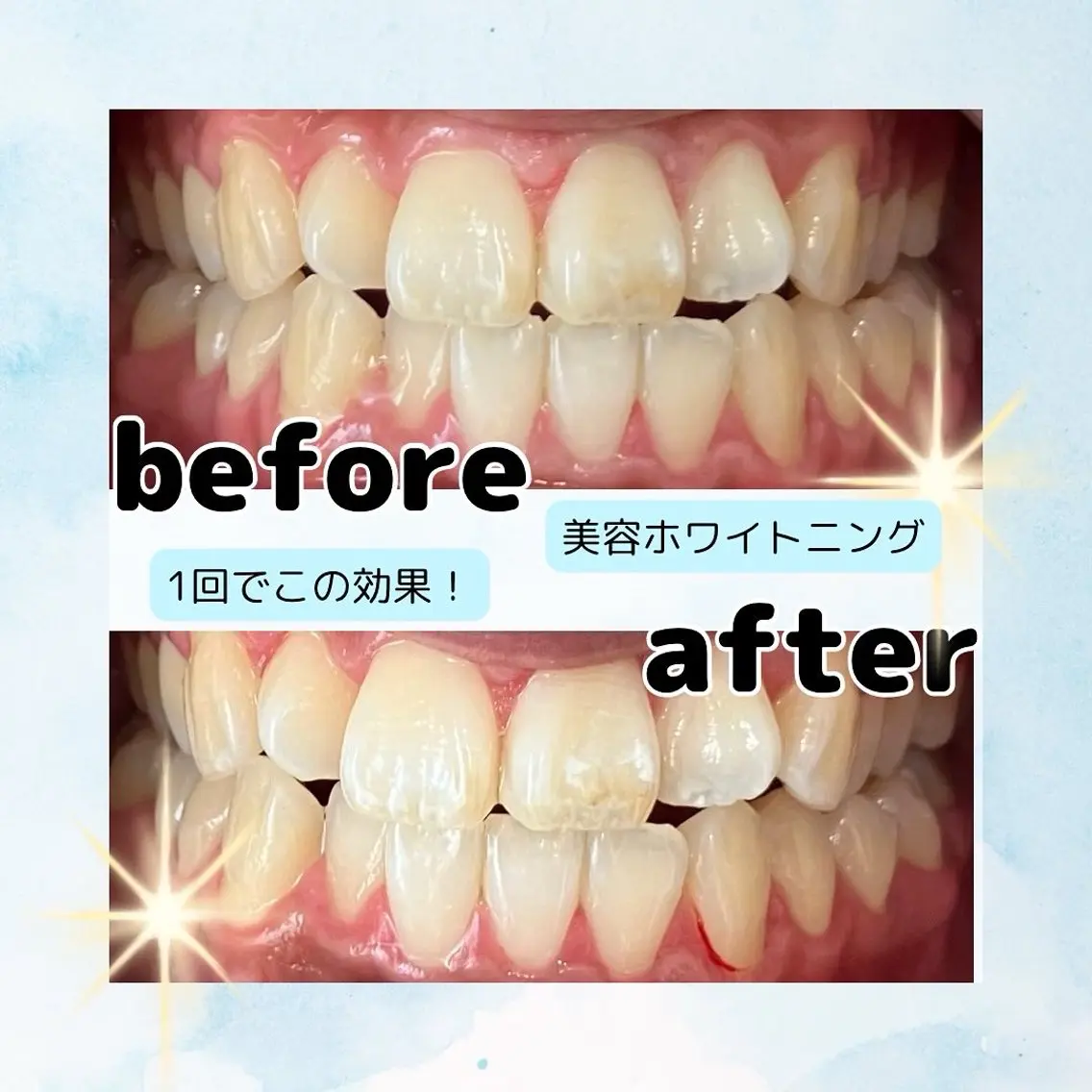 ホワイトニングサロン Soleilのその他イメージ
