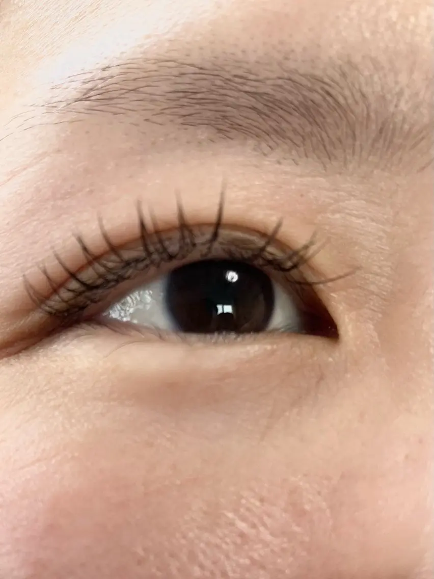 フラットラッシュ100本の写真