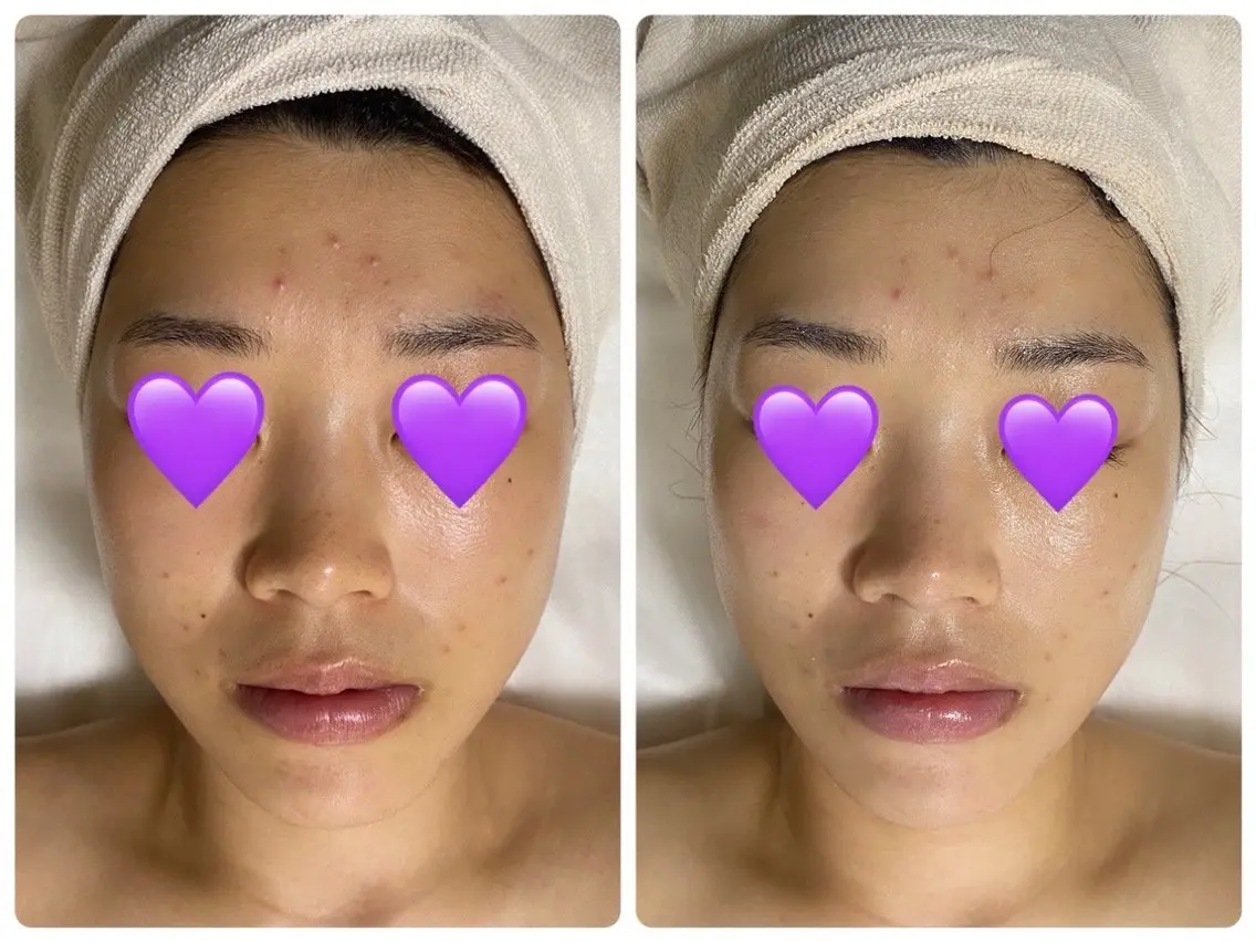 COCO beautyサロンのエステ・リラクイメージ