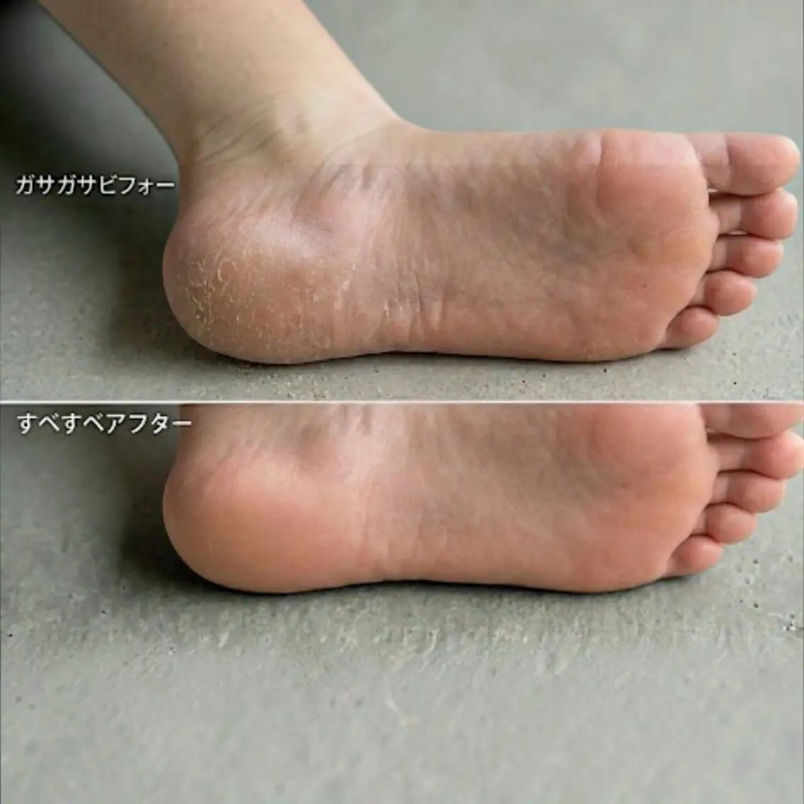 ネイル フットネイル 水無月 ミナのネイルデザイン