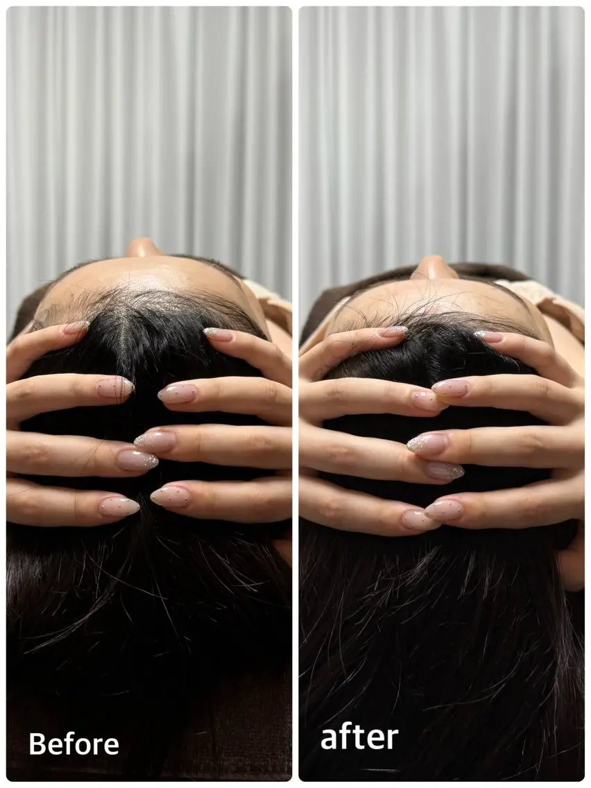 【究極の小顔コース！！】頭蓋骨矯正付き100min✨の写真