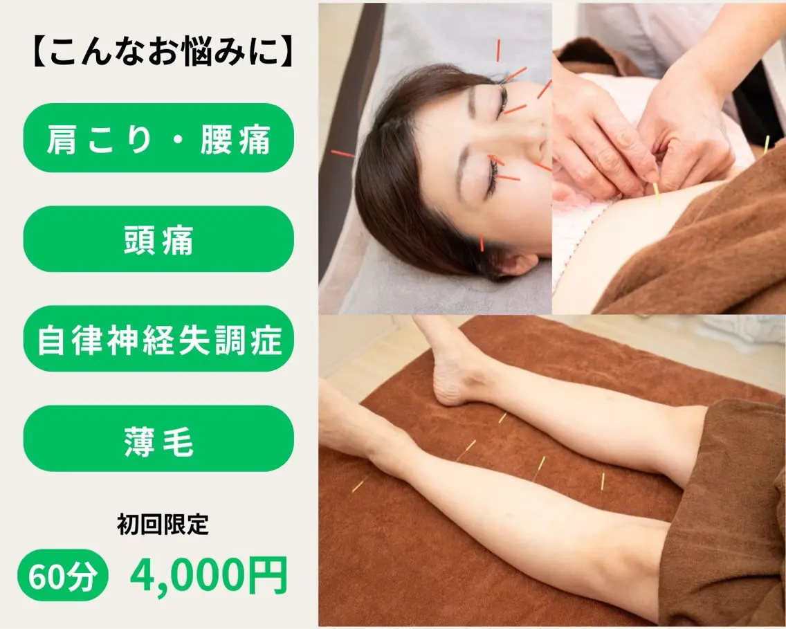全身調整コース（全身への鍼＋お辛いところ）の写真