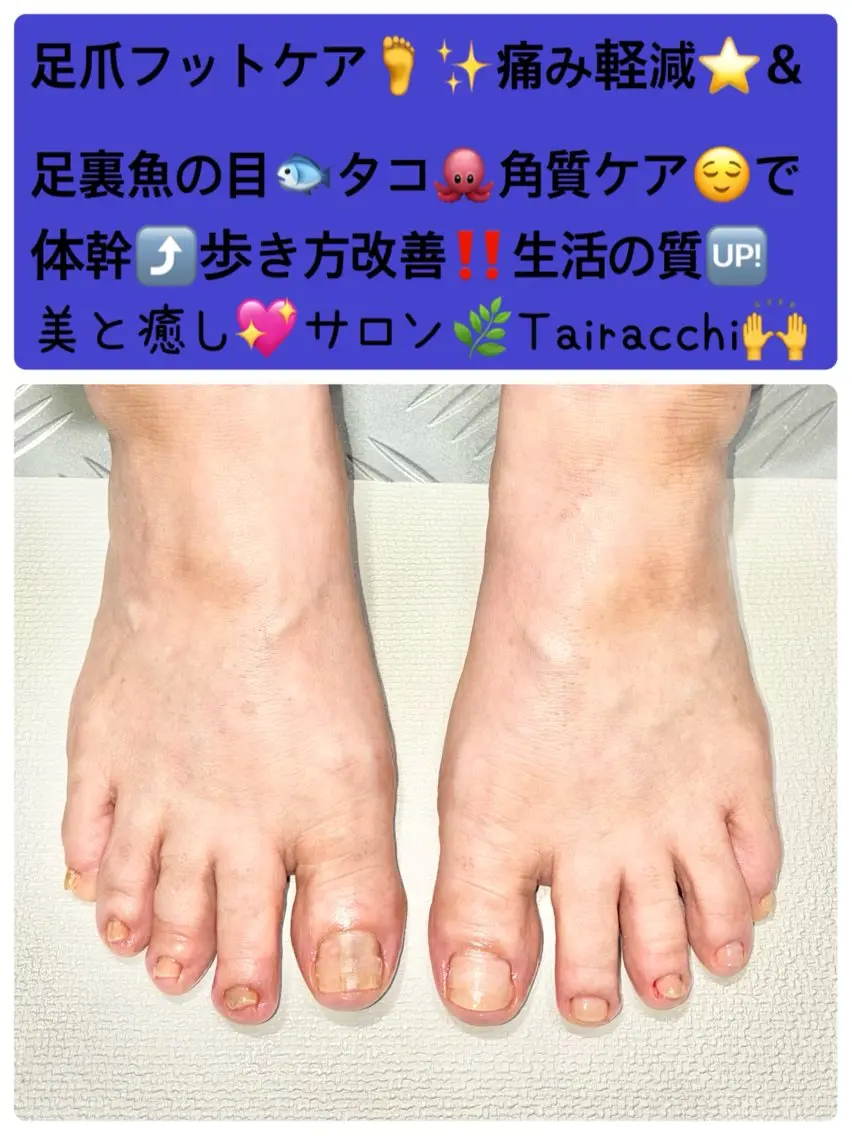 ネイル フットネイル Tairacchi タイラッチのエステ・リラクイメージ