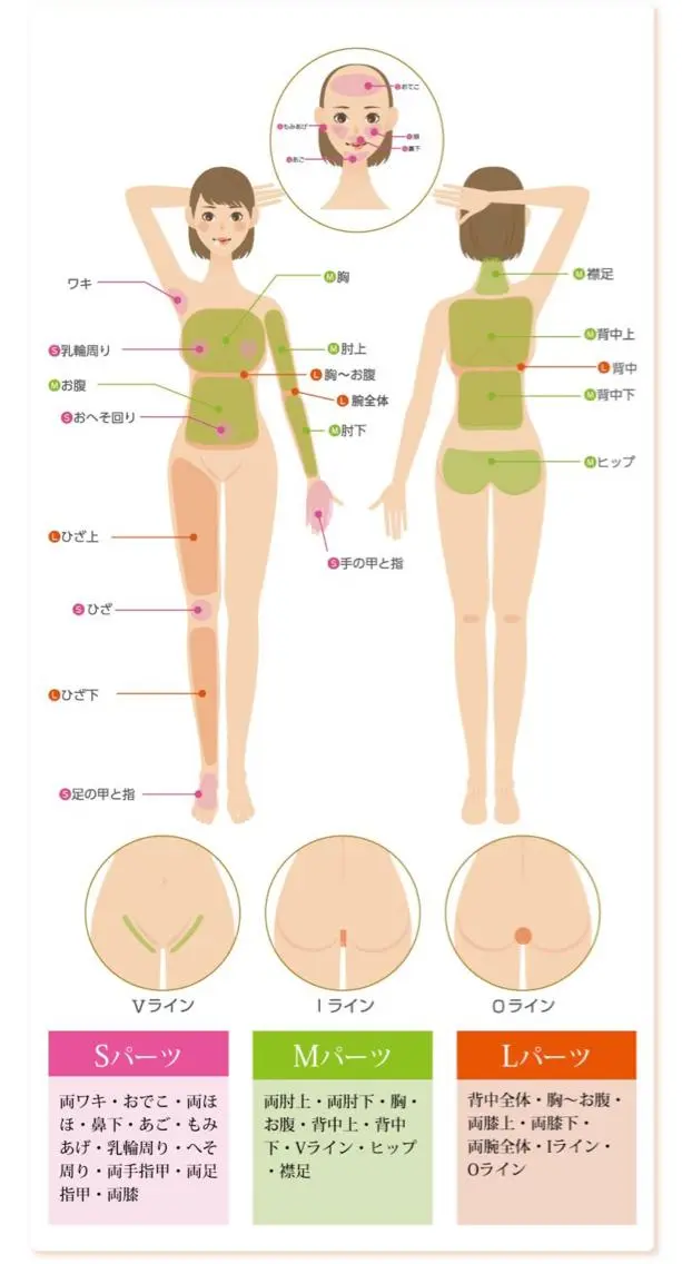 VIO脱毛 (各パーツも有り￥1500～)の写真