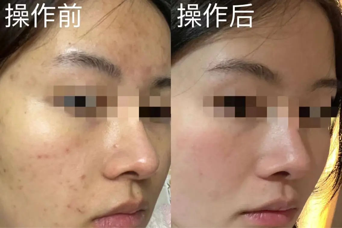 マツエク・マツパ 愛維美水光専門店 川崎彩鳳のエステ・リラクイメージ