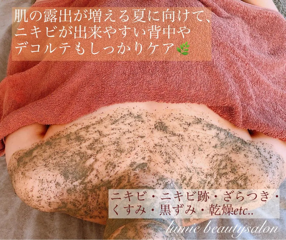 本気で肌荒れを治したい方にオススメ❣️剥けない幹細胞ハーブピーリング【デコルテ】2gの写真