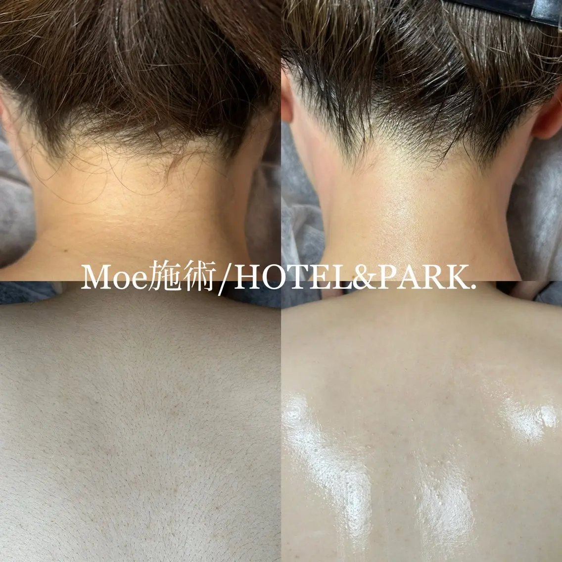 HOTEL&PARK .Moeワックス脱毛のエステ・リラクイメージ