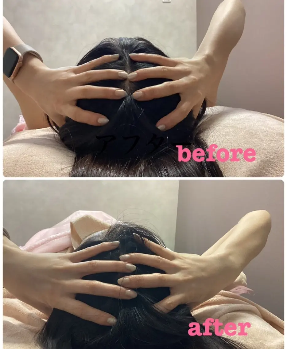【ミニモ限定】脳疲労★眼精疲労★即刻小顔★ドライヘッドスパ頭蓋骨矯正の写真