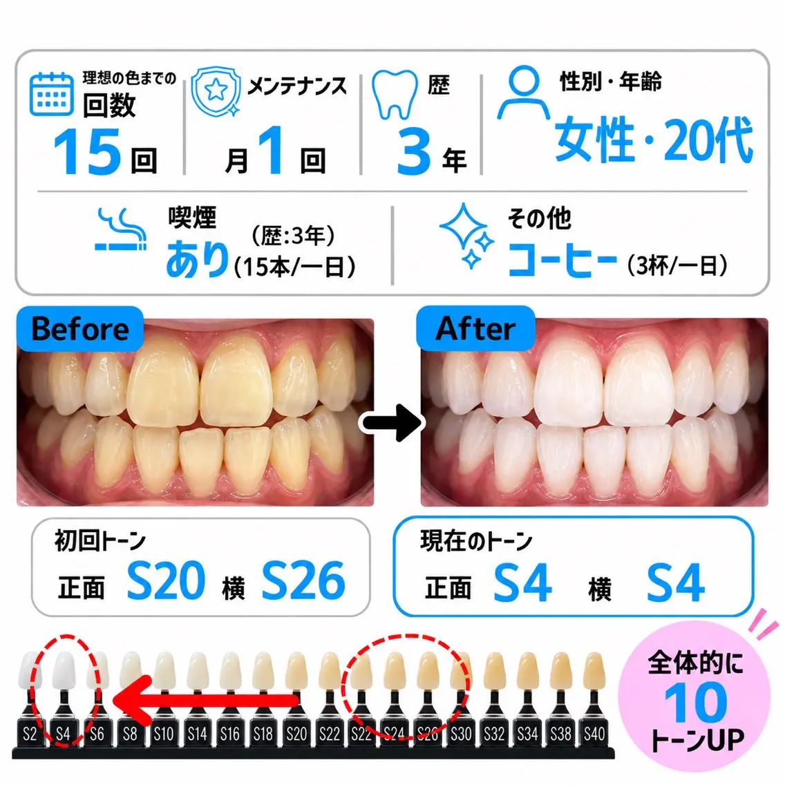 ホワイトニング ショップ多摩店のその他イメージ